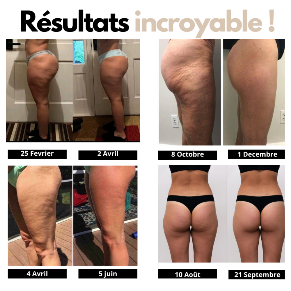 Legging Solène - Legging 3D Anti-cellulite